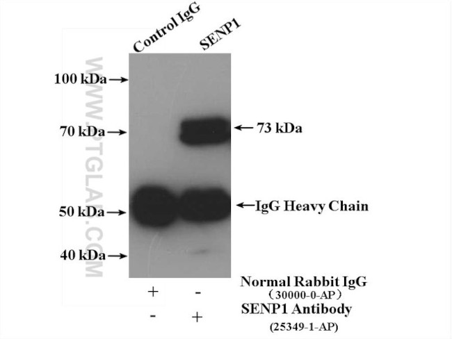 SENP1 Antibody in Immunoprecipitation (IP)