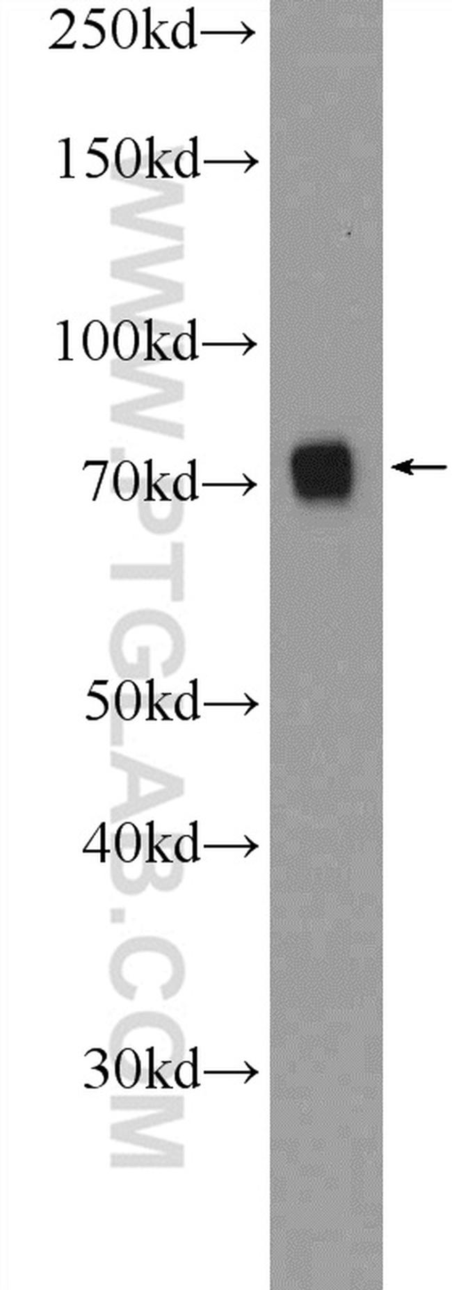 SENP1 Antibody in Western Blot (WB)