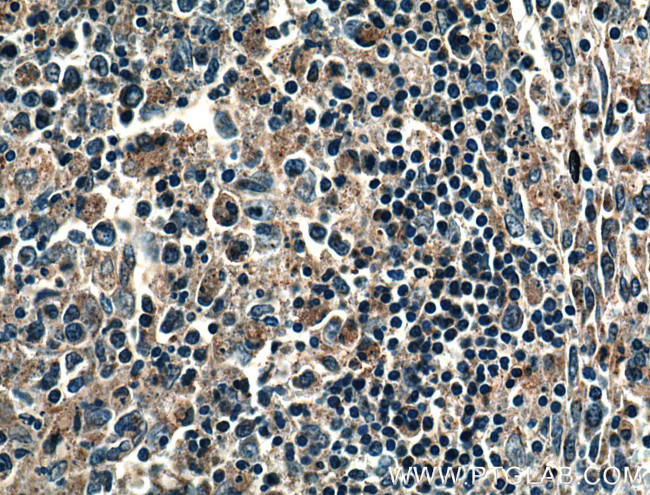 NOX5 Antibody in Immunohistochemistry (Paraffin) (IHC (P))