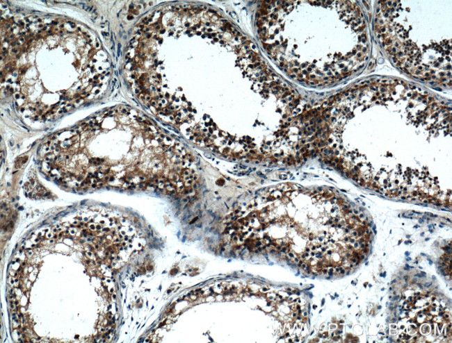 NOX5 Antibody in Immunohistochemistry (Paraffin) (IHC (P))