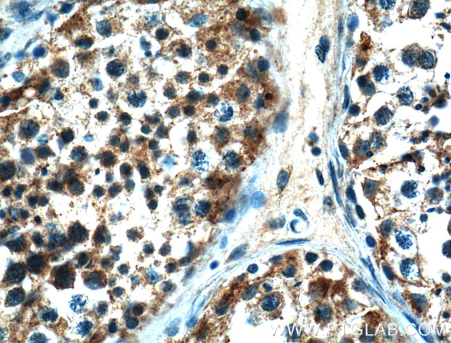 NOX5 Antibody in Immunohistochemistry (Paraffin) (IHC (P))