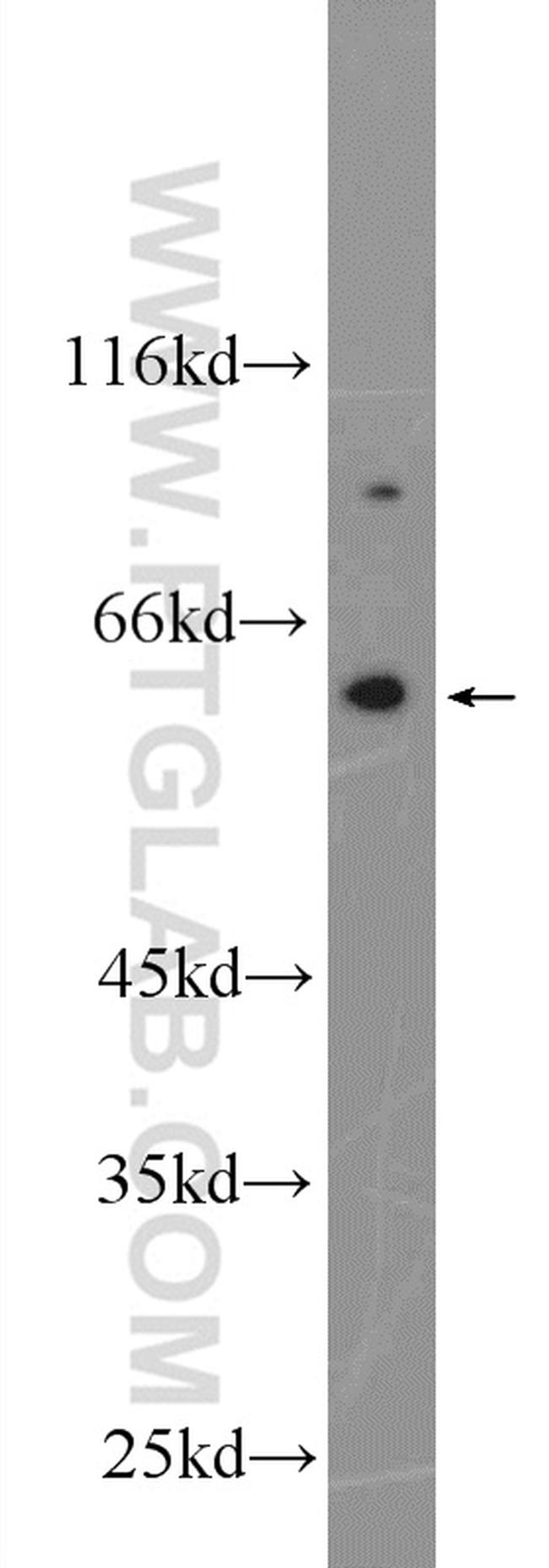 NOX5 Antibody in Western Blot (WB)