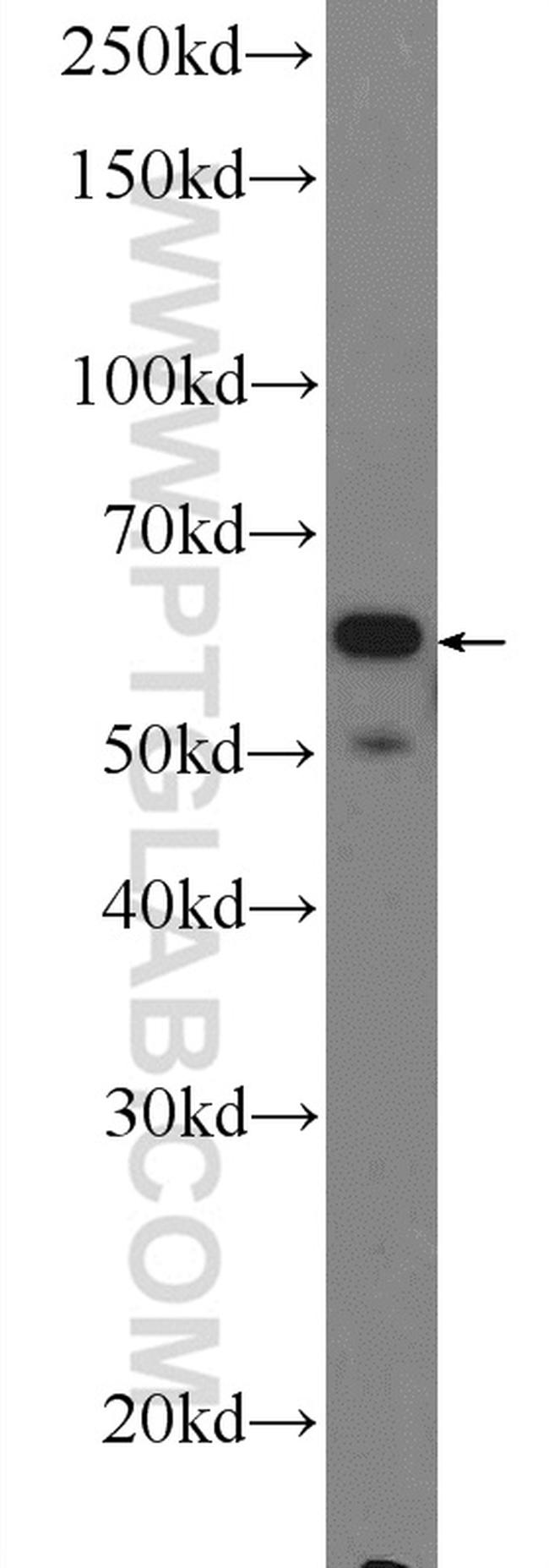 NOX5 Antibody in Western Blot (WB)