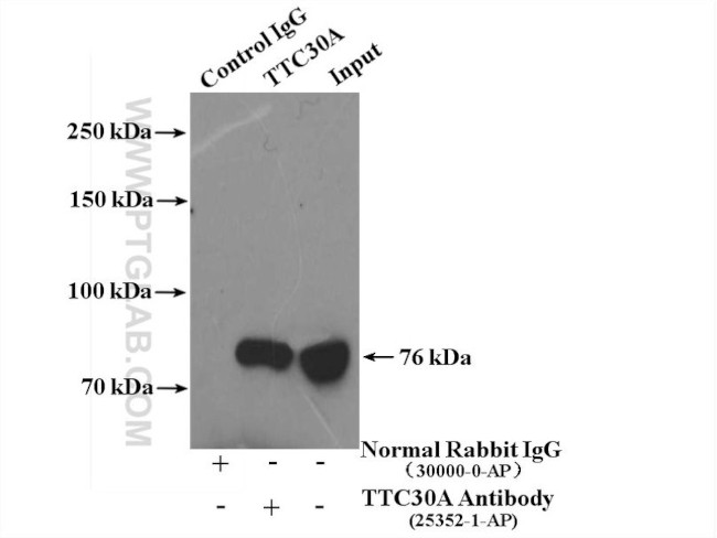 TTC30A Antibody in Immunoprecipitation (IP)