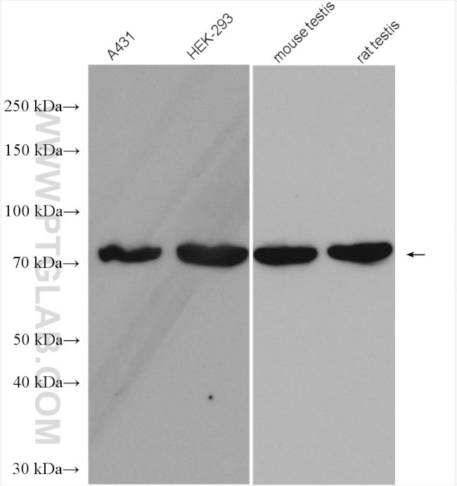 TTC30A Antibody in Western Blot (WB)