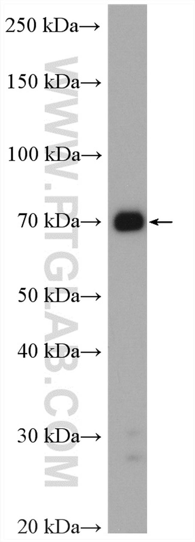 TTC30A Antibody in Western Blot (WB)