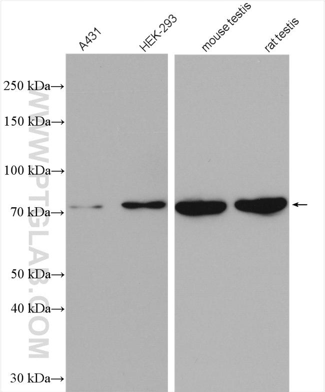 TTC30A Antibody in Western Blot (WB)