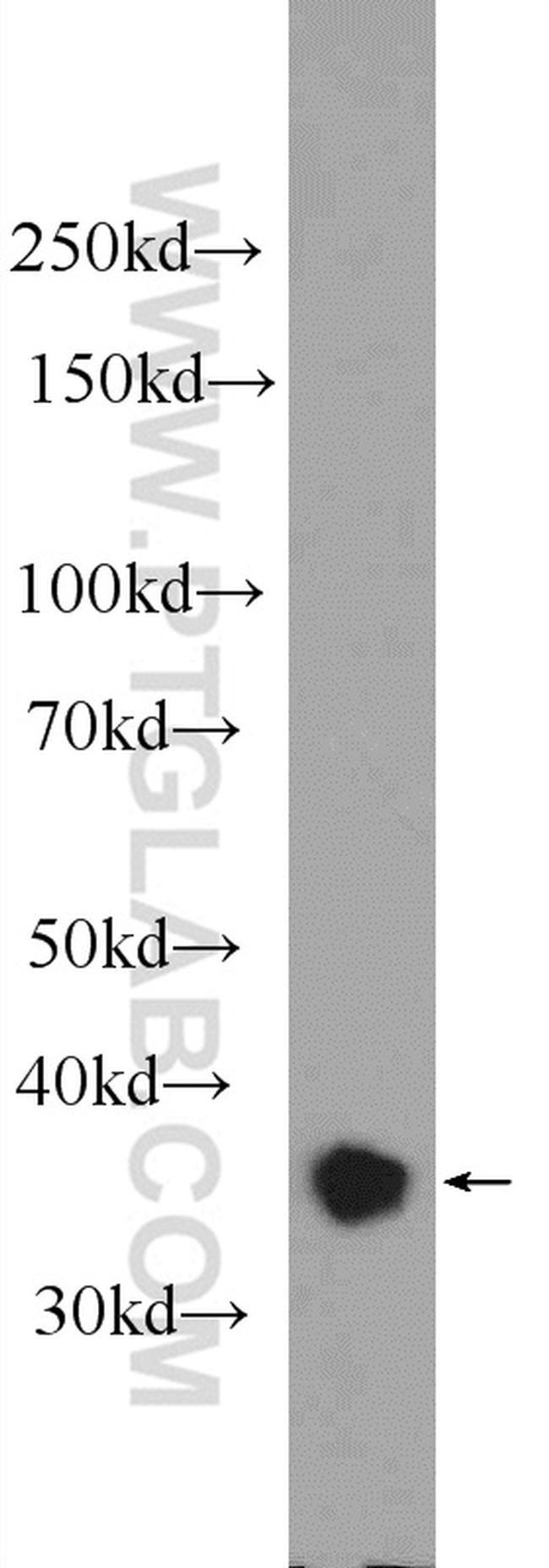 YOD1 Antibody in Western Blot (WB)