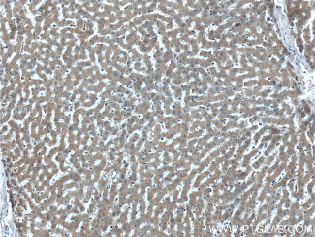 PROC Antibody in Immunohistochemistry (Paraffin) (IHC (P))