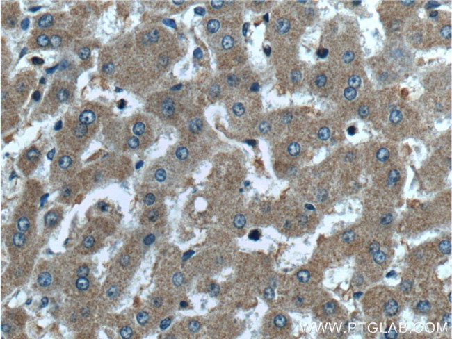 PROC Antibody in Immunohistochemistry (Paraffin) (IHC (P))