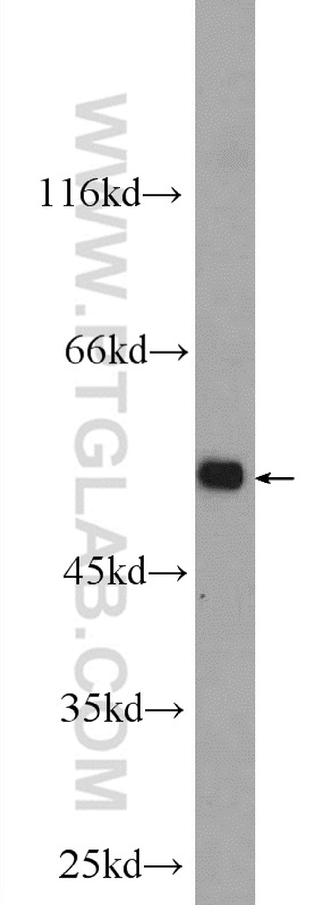 PROC Antibody in Western Blot (WB)