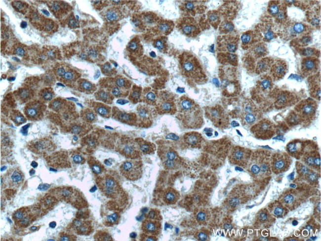 MTF1 Antibody in Immunohistochemistry (Paraffin) (IHC (P))