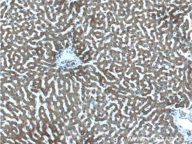 MTF1 Antibody in Immunohistochemistry (Paraffin) (IHC (P))