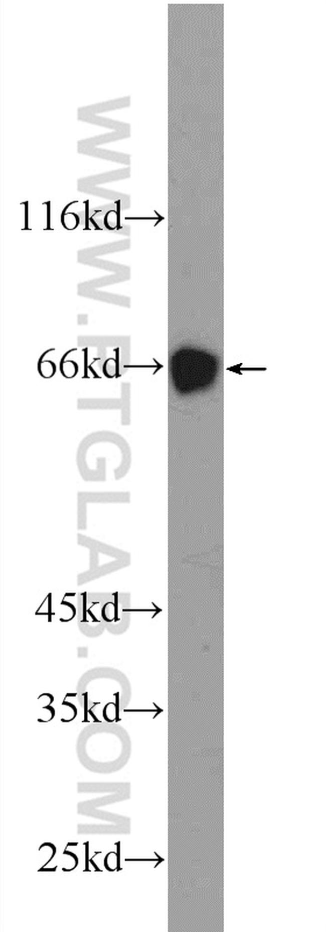 MTF1 Antibody in Western Blot (WB)