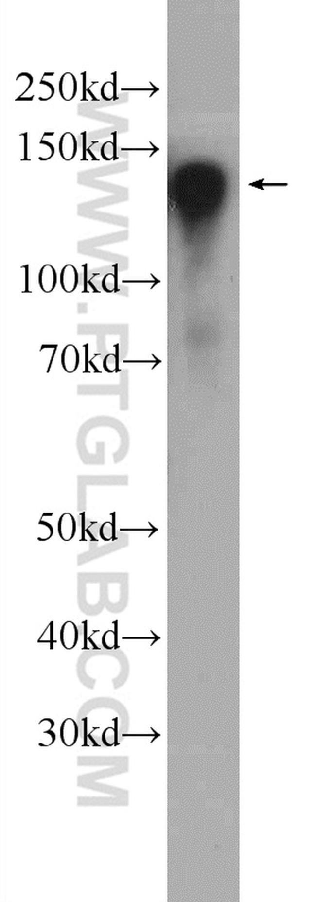 CYTSA Antibody in Western Blot (WB)