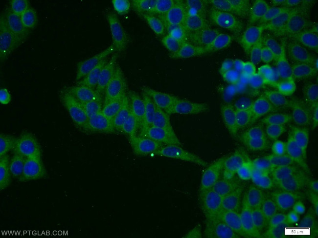 CYTSA Antibody in Immunocytochemistry (ICC/IF)