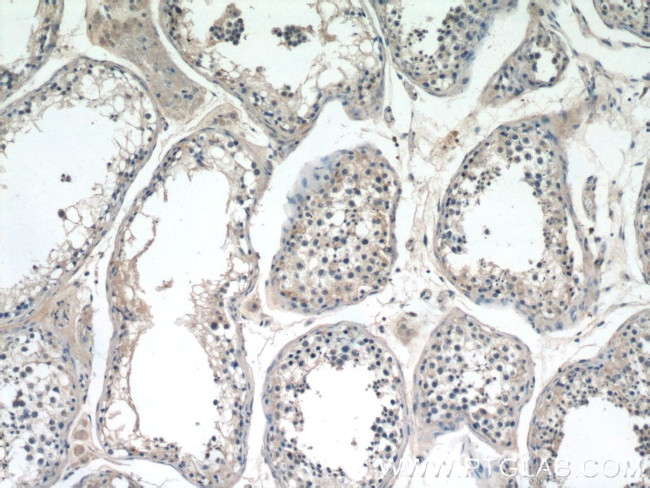 CYTSA Antibody in Immunohistochemistry (Paraffin) (IHC (P))