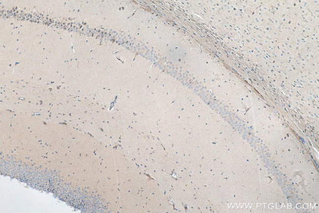 CYTSA Antibody in Immunohistochemistry (Paraffin) (IHC (P))