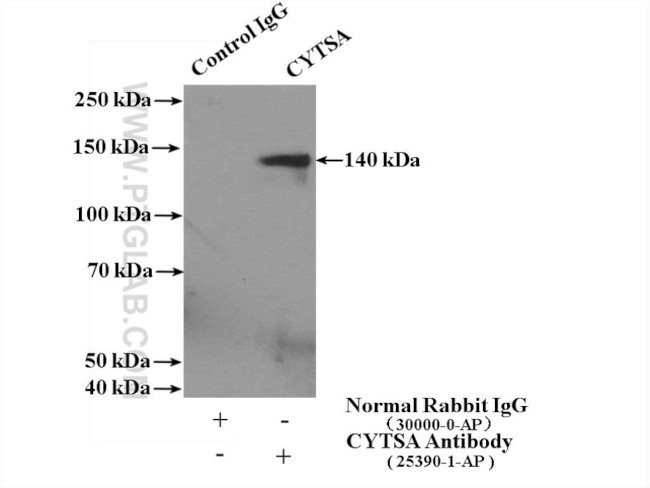 CYTSA Antibody in Immunoprecipitation (IP)