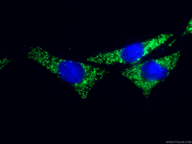 SLC25A22 Antibody in Immunocytochemistry (ICC/IF)