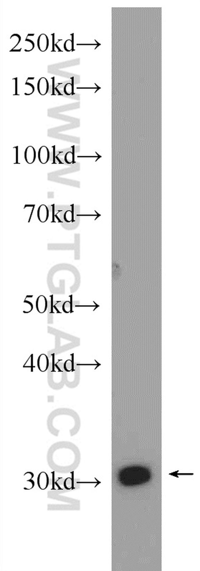 SLC25A22 Antibody in Western Blot (WB)