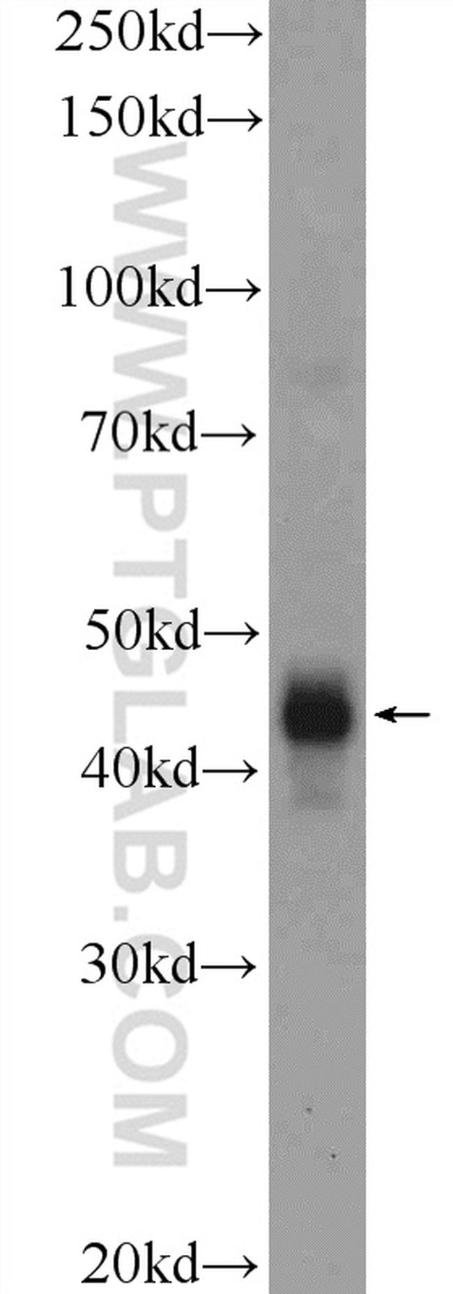 CD209 Antibody in Western Blot (WB)