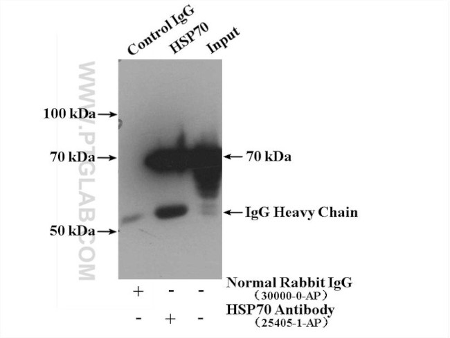 HSP70 Antibody in Immunoprecipitation (IP)