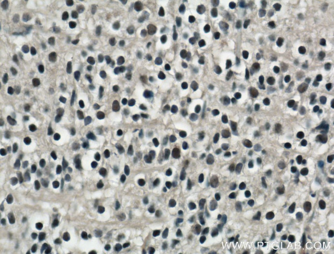 SOX15 Antibody in Immunohistochemistry (Paraffin) (IHC (P))