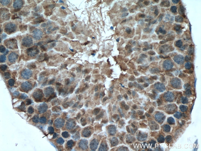 SRPK2 Antibody in Immunohistochemistry (Paraffin) (IHC (P))