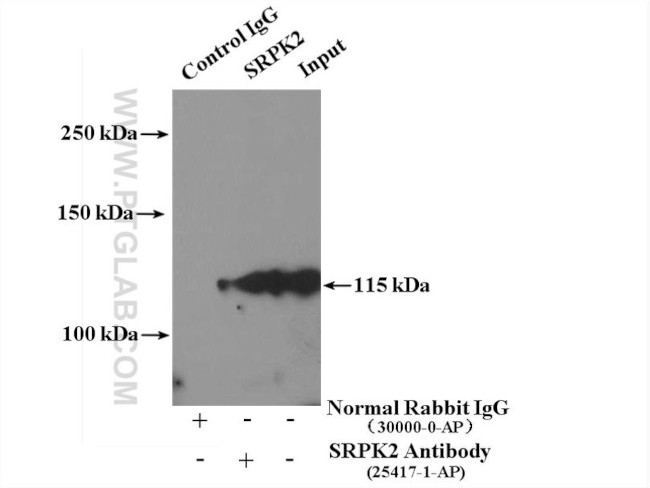 SRPK2 Antibody in Immunoprecipitation (IP)