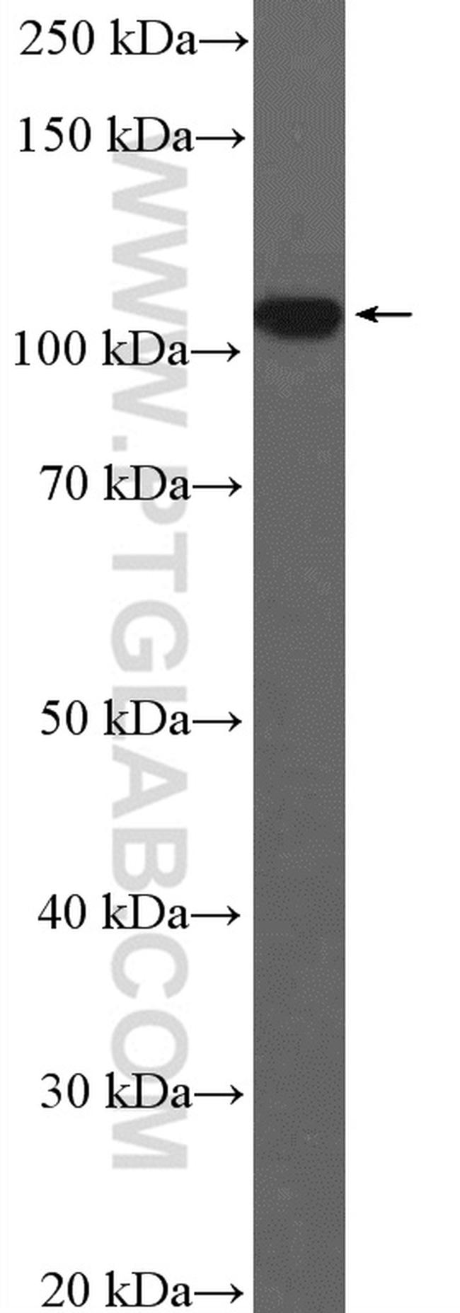 SRPK2 Antibody in Western Blot (WB)