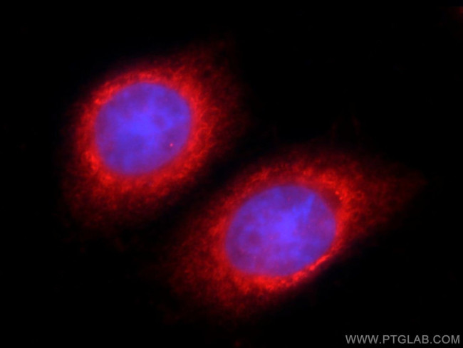 TSC22D2 Antibody in Immunocytochemistry (ICC/IF)