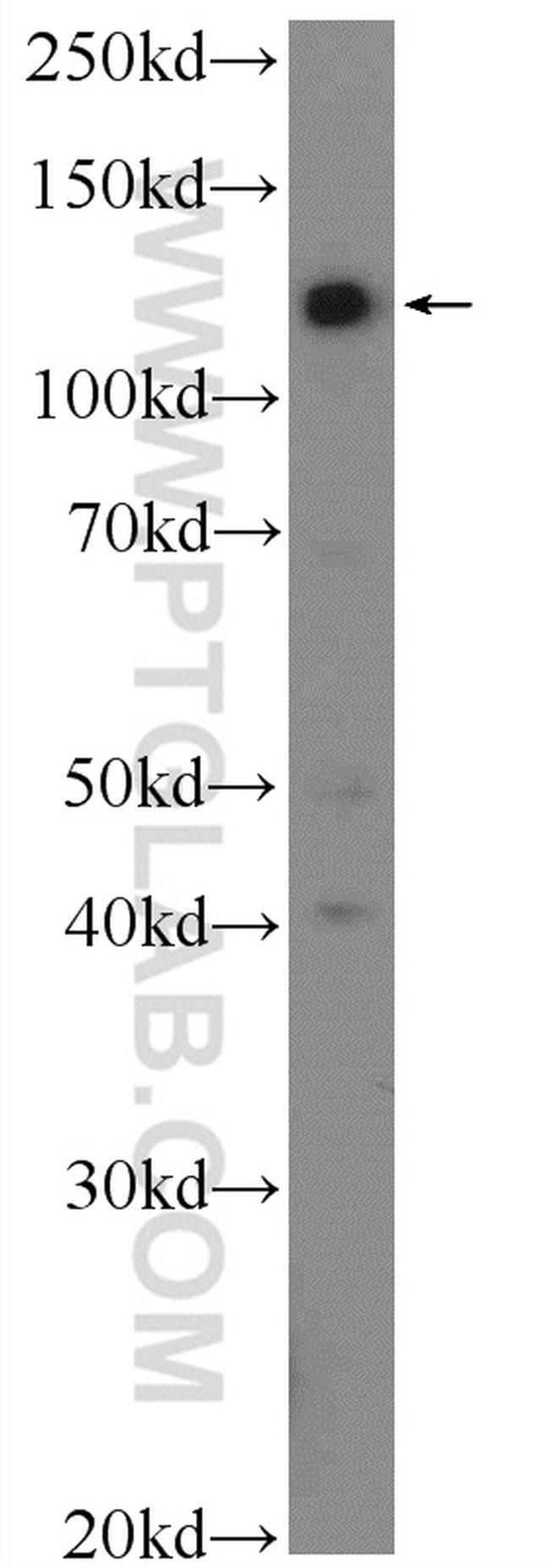 TSC22D2 Antibody in Western Blot (WB)