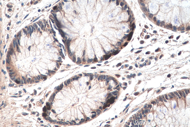 DKC1 Antibody in Immunohistochemistry (Paraffin) (IHC (P))