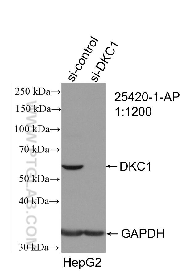 DKC1 Antibody in Western Blot (WB)