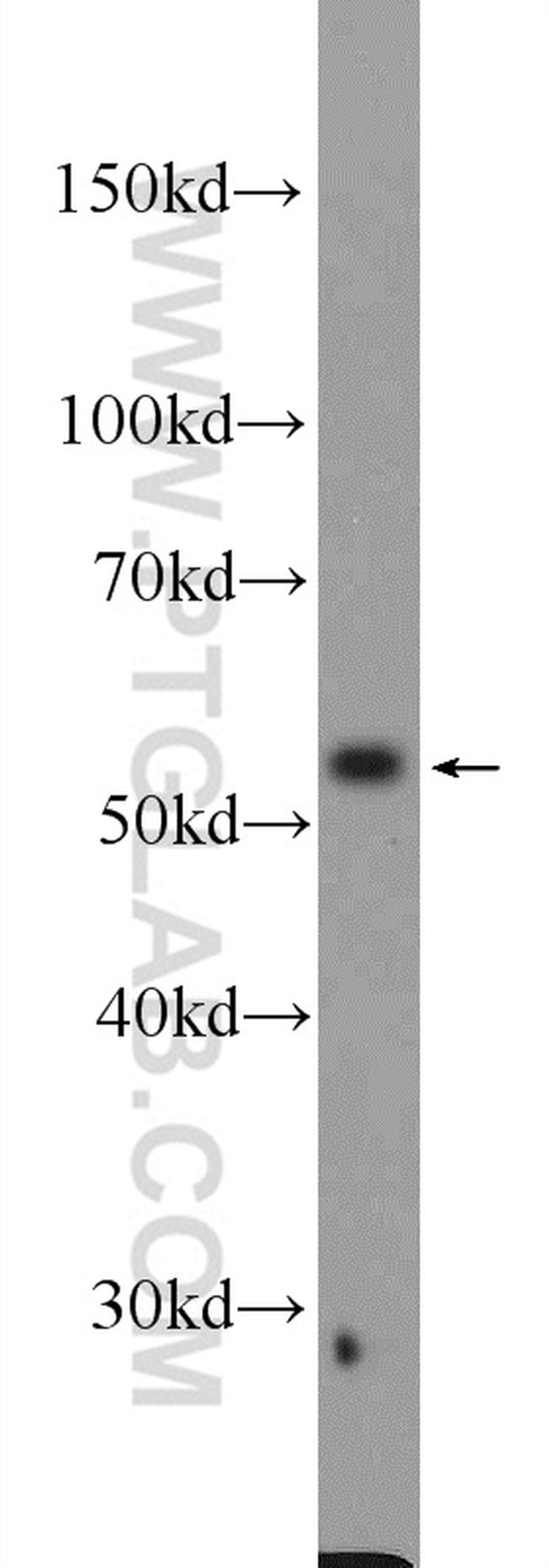 DKC1 Antibody in Western Blot (WB)