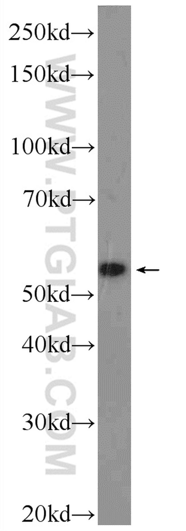 DKC1 Antibody in Western Blot (WB)