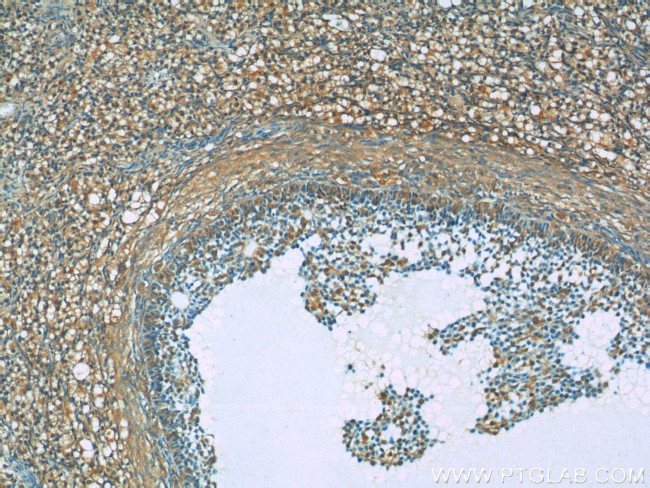 BIVM Antibody in Immunohistochemistry (Paraffin) (IHC (P))