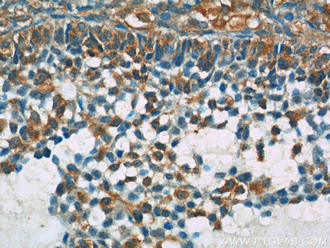 BIVM Antibody in Immunohistochemistry (Paraffin) (IHC (P))