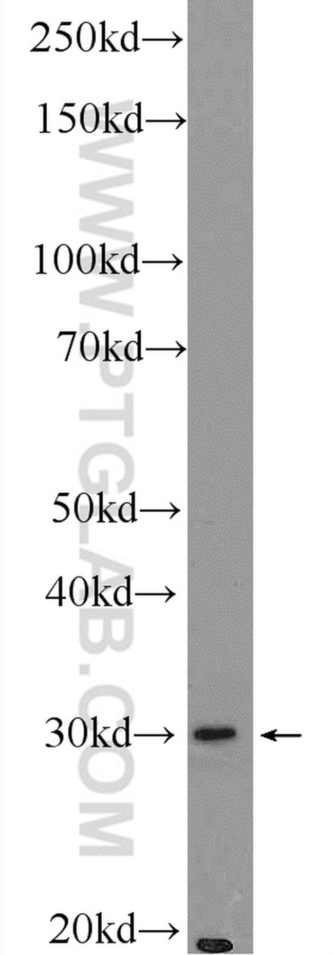 BIVM Antibody in Western Blot (WB)