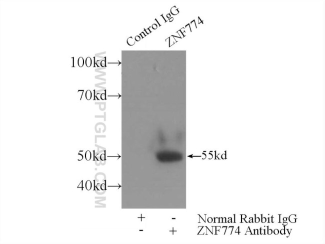 ZNF774 Antibody in Immunoprecipitation (IP)