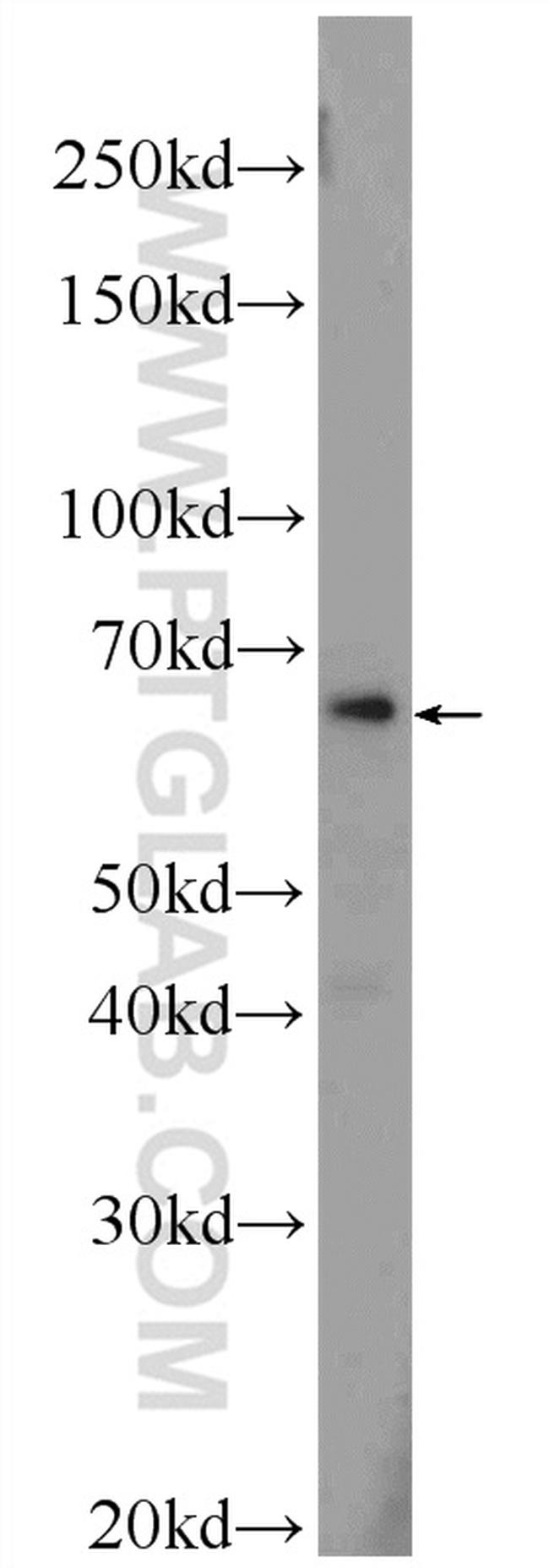 ZNF774 Antibody in Western Blot (WB)