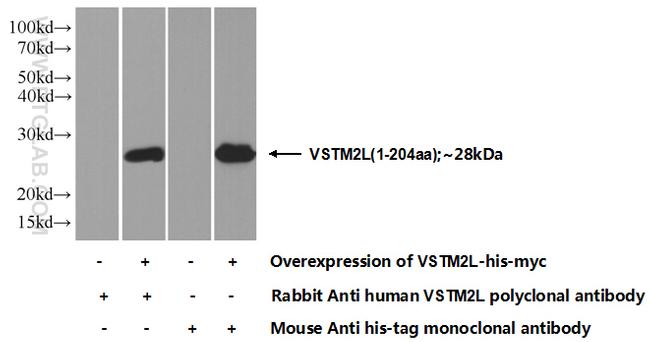 VSTM2L Antibody in Western Blot (WB)