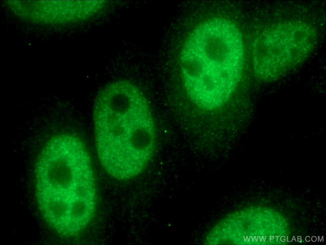 TWIST1 Antibody in Immunocytochemistry (ICC/IF)