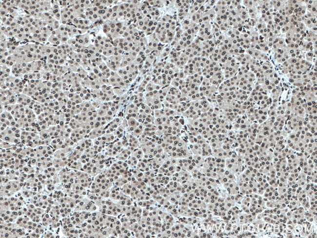 TWIST1 Antibody in Immunohistochemistry (Paraffin) (IHC (P))