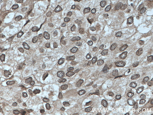 TWIST1 Antibody in Immunohistochemistry (Paraffin) (IHC (P))