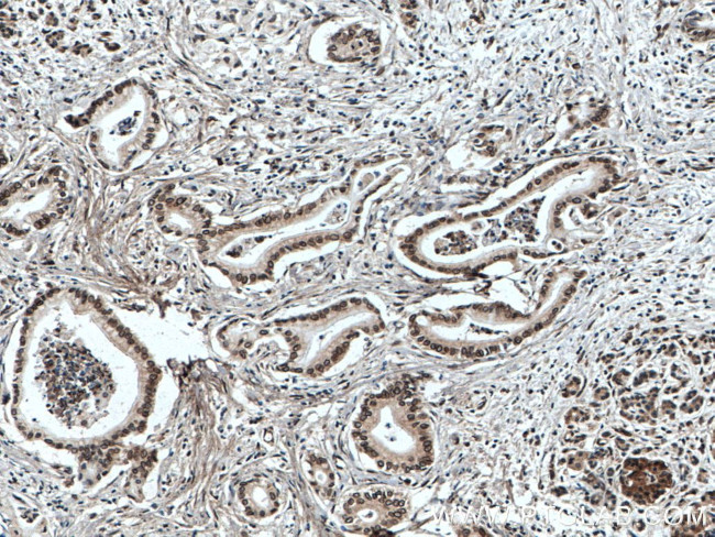 TWIST1 Antibody in Immunohistochemistry (Paraffin) (IHC (P))