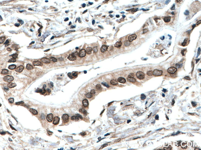 TWIST1 Antibody in Immunohistochemistry (Paraffin) (IHC (P))