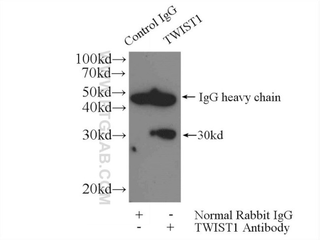 TWIST1 Antibody in Immunoprecipitation (IP)