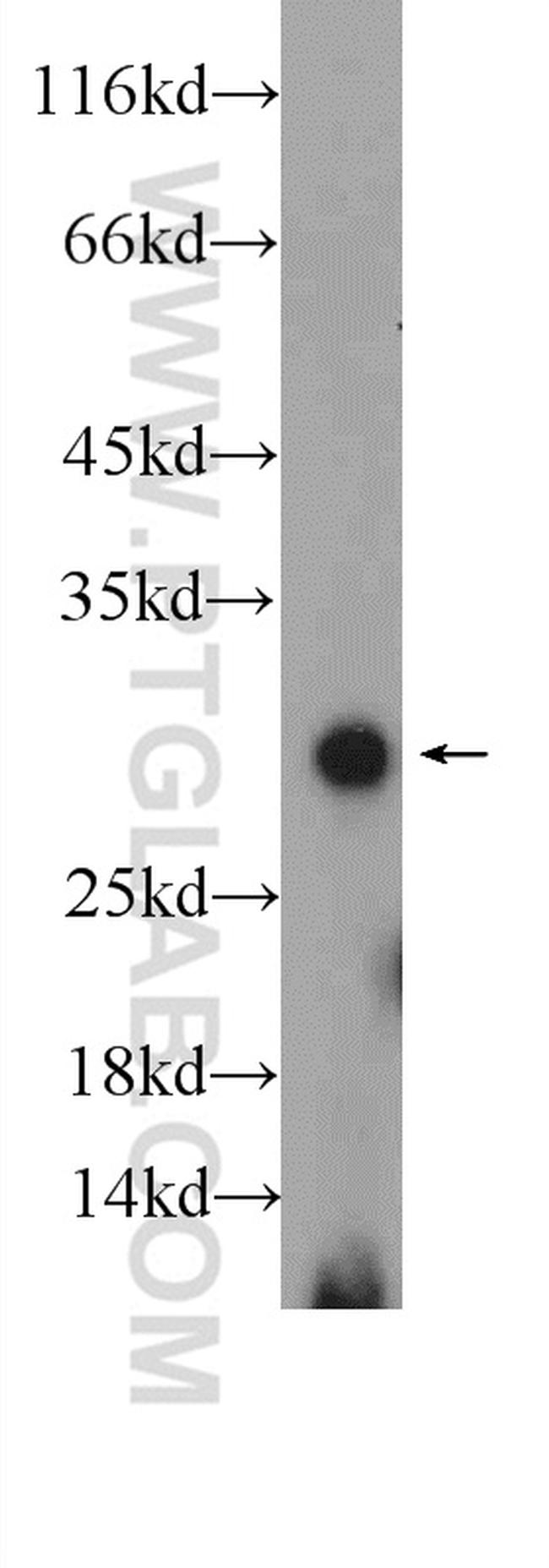 TWIST1 Antibody in Western Blot (WB)